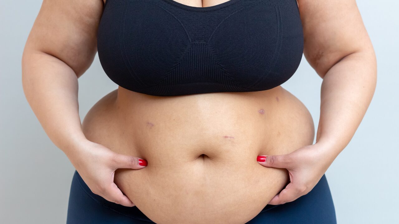 5 Passos para Vencer a Gordura na Barriga