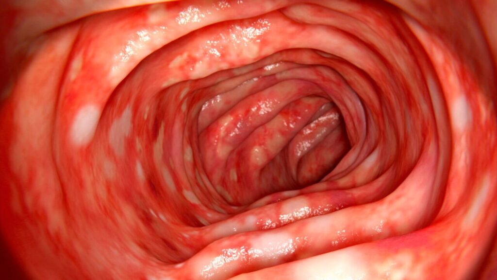 O que é Endoscopia?